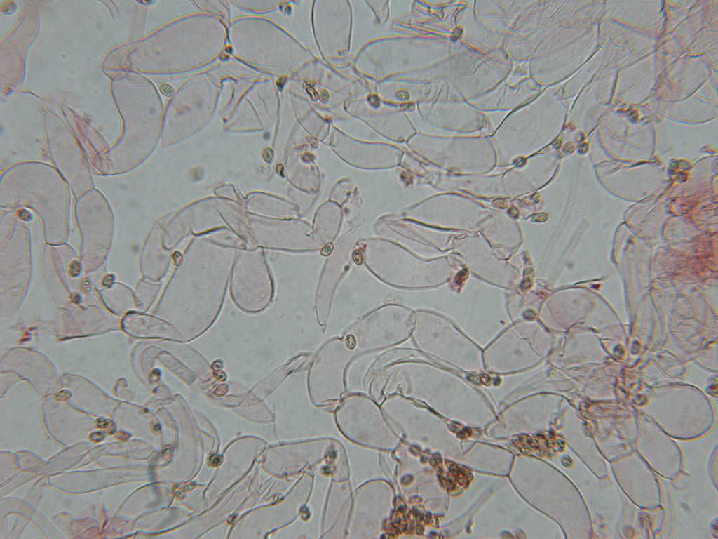 O l''uno... o l''atro???